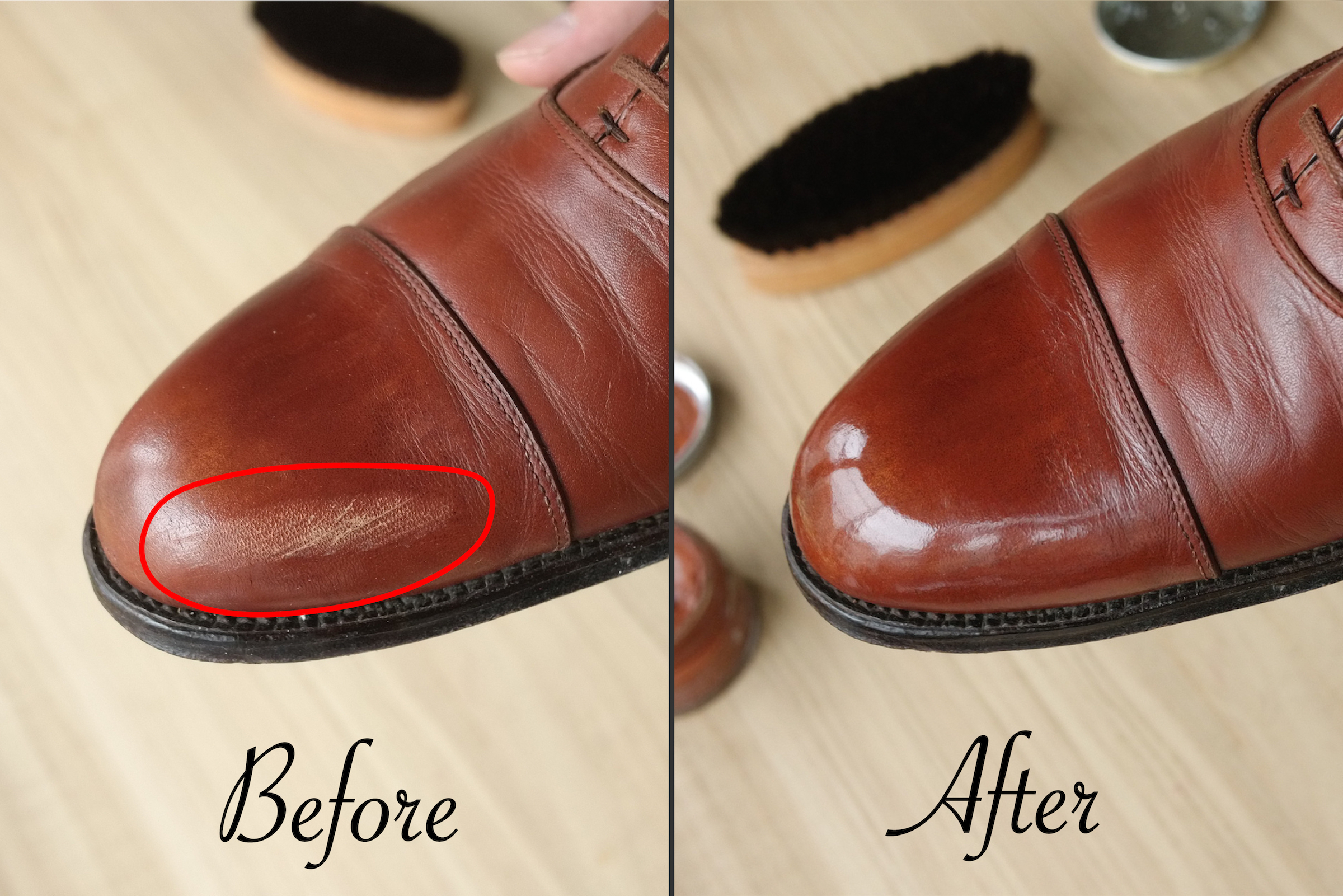 どのような症状がありますか?